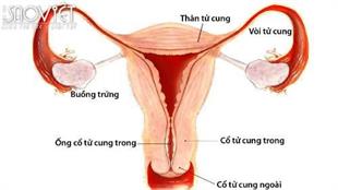 Thủ phạm gây ung thư cổ tử cung nhiều bạn tình nên cảnh giác